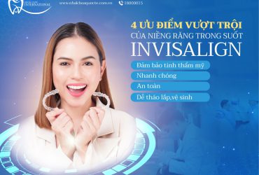 4 ưu điểm vượt trội của niềng răng trong suốt Invisalign